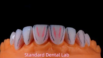 Standard Dental Lab Co., Limited สายการผลิตของผู้ผลิต