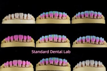 Standard Dental Lab Co., Limited สายการผลิตของผู้ผลิต