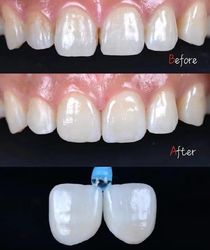 Standard Dental Lab Co., Limited สายการผลิตของผู้ผลิต