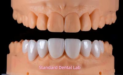 Standard Dental Lab Co., Limited สายการผลิตของผู้ผลิต
