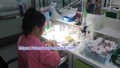 Standard Dental Lab Co., Limited สายการผลิตของผู้ผลิต