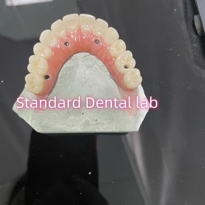 ซื้อ All On Four Six Ivoclar Zirconia Implant Bridge ทิตาเนียมบาร์ กับยางคอพอร์เซลีนสีชมพู การผลิตออนไลน์