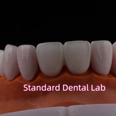 ซื้อ ใส Emax Zirconia Laminate Veneers โปรเซลีนฟันฟันฟานเนอร์ การผลิตออนไลน์