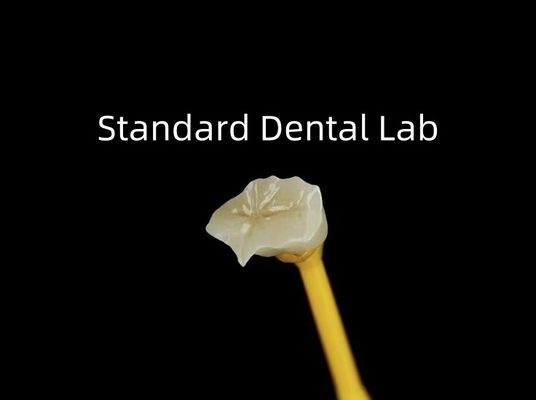 ซื้อ โปรเซลีนฟัน Inlay Onlay Zirconia Emax ความสวยงามสูง การผลิตออนไลน์