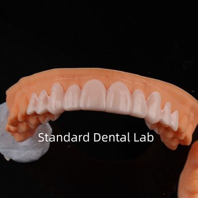 ซื้อ สวยงามสูง ฟัน Snap On Smile สมานด์ฟันแล็บ การผลิตออนไลน์