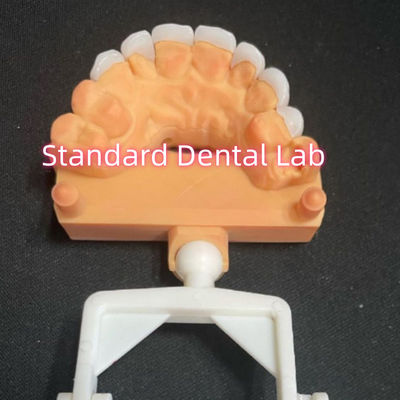 ซื้อ ลายธรรมชาติ ลายละมุน Zirconia Emax Veneers ความหนา 0.6mm การผลิตออนไลน์
