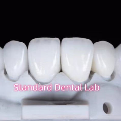 ซื้อ การฟื้นฟูสีฟันแบบธรรมชาติ การผลิตออนไลน์