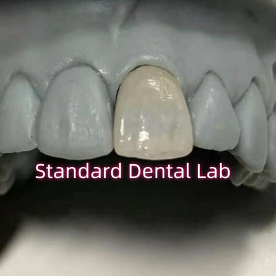 ซื้อ การฟันที่ฟื้นฟูฟัน Emax ฟัน Zirconia ราชมงคล Porcelain การผลิตออนไลน์