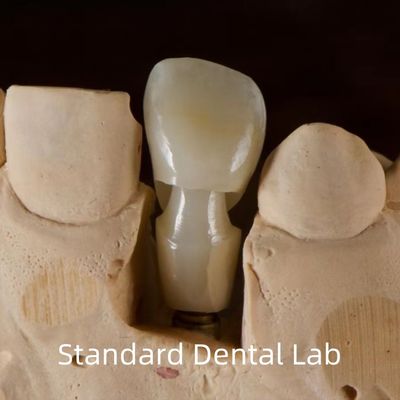ซื้อ การปลูกฟัน Tibase Zirconia Abutment Titanium ความแม่นยําที่กําหนดเอง การผลิตออนไลน์