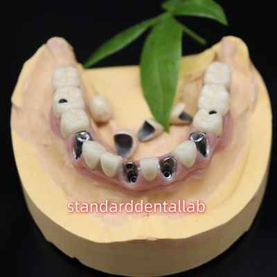 ซื้อ โครงการปรับปรุงฟันที่ติดเชื้อสกรู โครงการปรับปรุงฟันที่ติดเชื้อสกรู การผลิตออนไลน์
