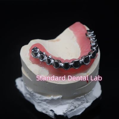 ซื้อ โครงการฟื้นฟูฟันแบบ Full Arch Malo Bridge สีซอร์คอนีา การผลิตออนไลน์