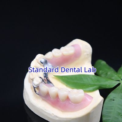 ซื้อ โครงสร้างฟันเทียมบางส่วนจากโลหะอะคริลิค ความสวยงามสูง SDL ห้องปฏิบัติการฟัน การผลิตออนไลน์