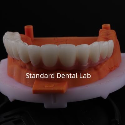 ซื้อ สวยเหมาะสม สีสวยงาม Zirconia Porcelain Crown สีชมพู Porcelain With Bleaching Shade การผลิตออนไลน์