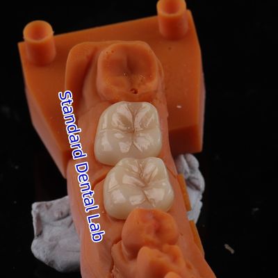 ซื้อ Full Contour Zirconia crown ทราสลูเซนซ์ 3D PRO ไม่มีโปรเซลิน Overlay สมาธิห้องปฏิบัติการฟัน การผลิตออนไลน์