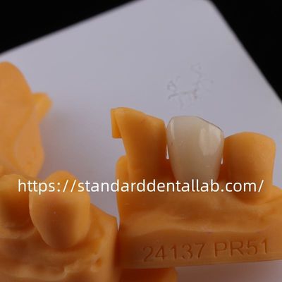 ซื้อ ครบวงจร ห้องปฏิบัติการฟัน ราชกุศล ใสสูง ราชกุศลซิลโคเนีย การผลิตออนไลน์