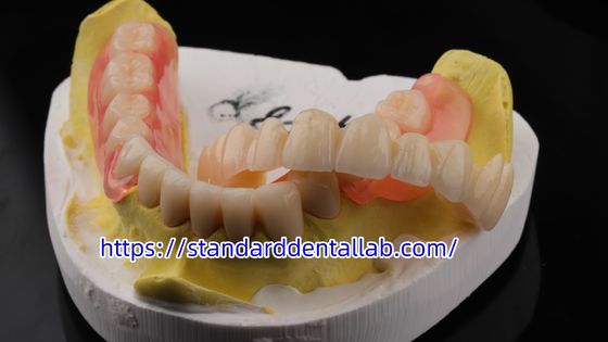 ซื้อ ความสวยงามสูง ฟัน TCS Valplast ฟันเทียมบางส่วนยืดหยุ่น ห้องปฏิบัติการฟัน Valplast Clap สีชมพู การผลิตออนไลน์
