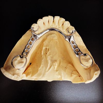 ซื้อ รากงาน Fast and Cast Co-Cr Metal Partional Denture Framework สําหรับนักทันตแพทย์ การผลิตออนไลน์