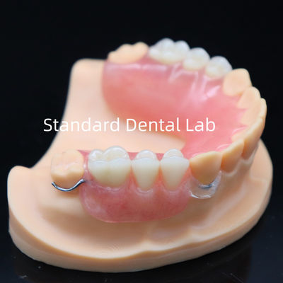 ซื้อ อีสเตติกสูง แปลงส่วนอะคริลิคด้วยขัดใสและฟันอะคริลิค China Dental Lab การผลิตออนไลน์