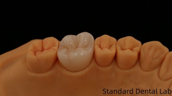 ซื้อ โนริเทค โปรเซลีน Full Contour Zirconia Crown Customized Vita Shade สําหรับการฟื้นฟูฟันแบบดิจิตอลโดยห้องปฏิบัติการฟัน การผลิตออนไลน์