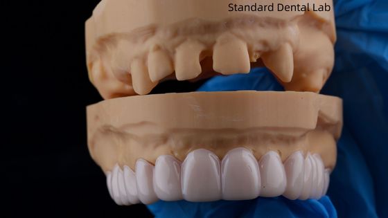 ซื้อ สวยงามสูง ฟัน Snap On Smile สมาธิฟันแล็บอุปกรณ์ฟันถอนได้ การผลิตออนไลน์