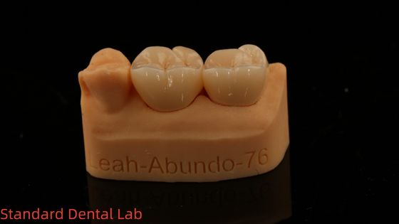 ซื้อ รางวัลห้องปฏิบัติการทันตแพทย์แบบแข็ง 3D โปร รางวัลซิกอร์โคนีเต็มความโปร่งใส การผลิตออนไลน์
