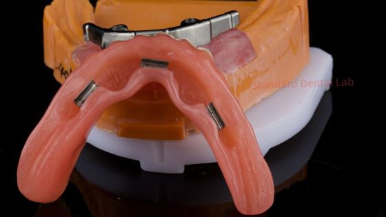 ซื้อ Ivoclar Digital Dental Implant Bar Prothesis with Attachments Full Acrylic Prothesis Titanium Implant Supported Protheses อุปกรณ์ปรับปรุงฟันที่ใช้กับเครื่องปรับปรุงฟันที่ใช้กับเครื่องปรับปรุงฟัน การผลิตออนไลน์