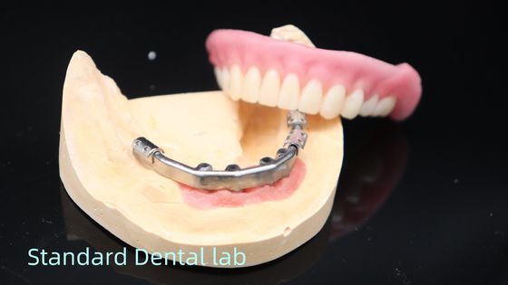 ซื้อ โปรเทชชั่นที่รองรับการปลูกทิตานี โปรเทชชั่น Ivoclar ที่แม่นยํา การผลิตออนไลน์