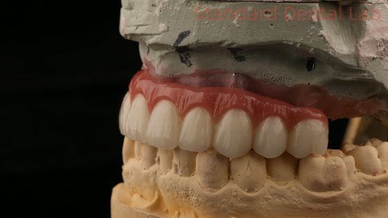 ซื้อ สกรูไฮบริดไทเทเนียม จับยึดมงกุฎปลูกฟัน All On 4 ปลูกฟัน Zirconia Bridge การผลิตออนไลน์