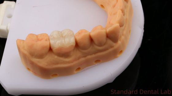 ซื้อ สารสว่าง Zirconia ทันตแพทย์ Inlay Onlay Crown เพื่อฟื้นฟูรูปร่างช่องท้องธรรมชาติ / ห้องปฏิบัติการฟันมาตรฐาน การผลิตออนไลน์