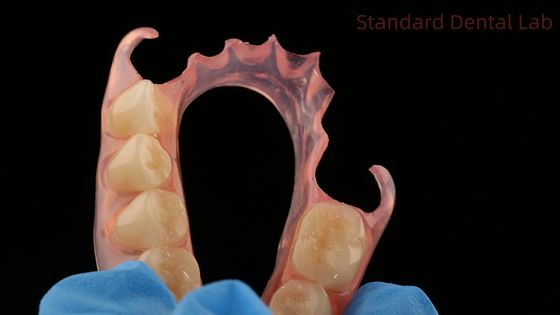 ซื้อ ทันตแพทย์ TCS Valplast ฟลักซิบ แปลงฟันส่วนหนึ่ง ห้องปฏิบัติการฟัน 3D Print Model Esthetics สูง การผลิตออนไลน์