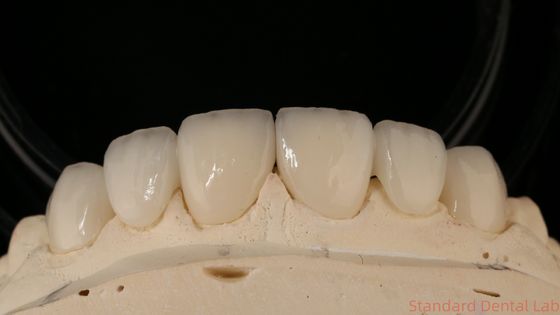 ซื้อ สะพานมงกุฎซิรคอนิยาที่แม่นยํา สะสมสบาย / สวยงาม 3-4 วัน เวลาตอบแทนรวดเร็ว การผลิตออนไลน์