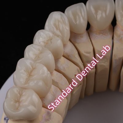 CAD CAM Digital Dental Laboratory PFZ รางวัลครูน่า