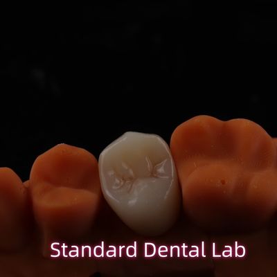 สวยงามสูง BruxZir Full Contour Zirconia Crowns สะพาน PFZ