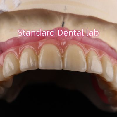ซีเมนต์ที่รวดเร็วและประหยัดเวลา ผลิตภัณฑ์ฝังฟัน Zirconia สายพาน