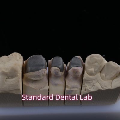 โลหะ Cast Post Core Crown Cocr เรตติเวฟแม่นยํา ครบ Zirconia Bruxier