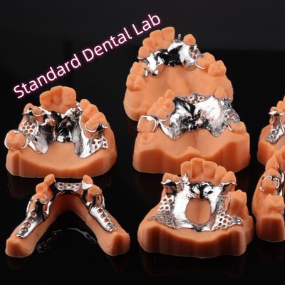 CAD CAM กรอบโลหะที่สามารถถอดออกได้ 3 รูปแบบ Exocad
