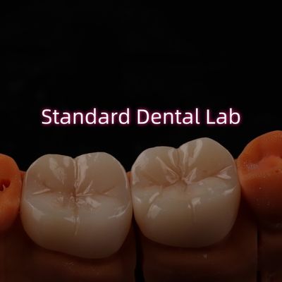 ห้องปฏิบัติการทันตกรรมครบวงจร Bruxier มโนลิทิก Zirconia Crown Bridge