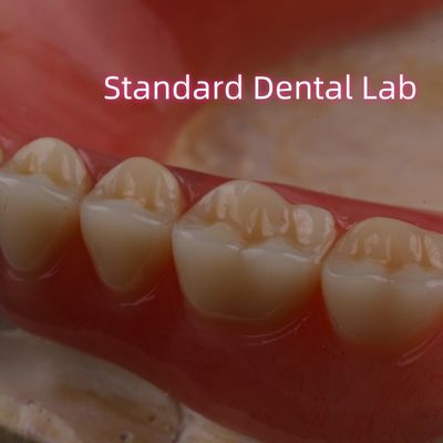 SDL การรักษาความร้อน แอคริลิค ปริมาณฟันบางส่วน Ivoclar ฟันฟัน ห้องทดลองฟัน ความแม่นยําสูง