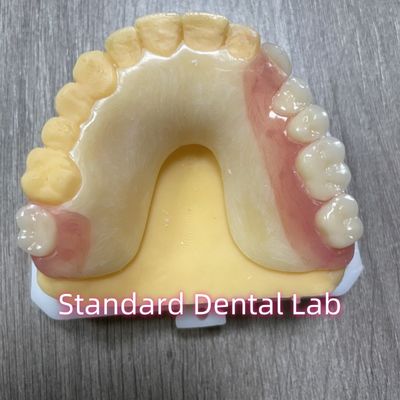 OEM ถอนได้ Cast Tooth Shade แอคริลิค ฟันเทียมส่วนหนึ่ง ด้วยแคลป