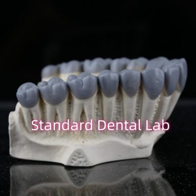 SDL ทันตแพทยศาสตร์ ห้องทดลองการวินิจฉัยดิจิตอล Wax Ups สะพานมงกุฎ