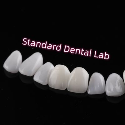 ทนต่อการบด Emax Zirconia Laminate Veneers ความโปร่งใส