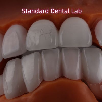 ลิทธิียม แผ่นดิจิเลคิต Ivoclar Emax Zirconia Laminate Veneers ใส OEM ODM