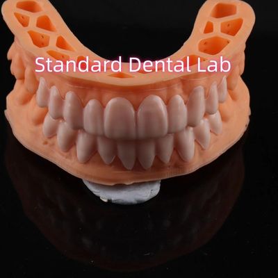 OEM ODM Pop On Veneers Custom Made Veneers สล็อปออนรอยยิ้ม