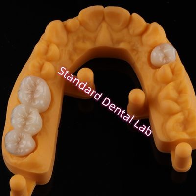รางวัลทั้งหมด โปรเซลน ซีรามิก ซิรคอนิอา Ivoclar ฟันสวย OEM
