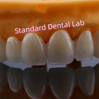 การ ซ่อมแซม ด้านหน้า สายพาน ซิรโคเนีย สําหรับ ฟันที่หายไป