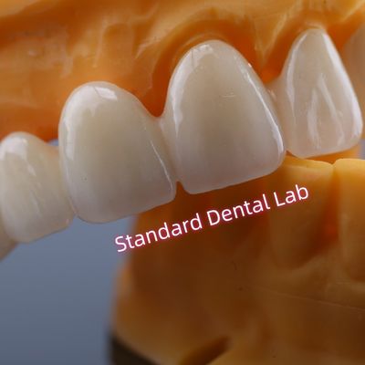 CAD CAM Mill Zirconia Crown Bridge สะสมทางชีวภาพสูง
