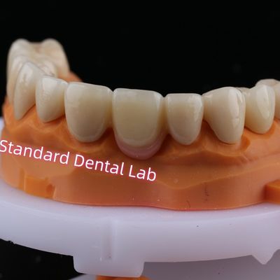 CAD CAM ดิจิตอล Milling ยูสเซอร์โคนย่า สายพานมงกุฎที่มีสีชมพูหมึก