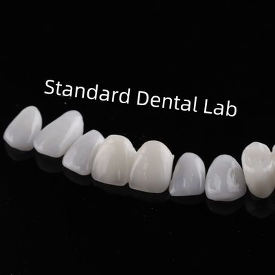 ฟันสวยงามสูง Emax Laminate Veneers ความโปร่งใส