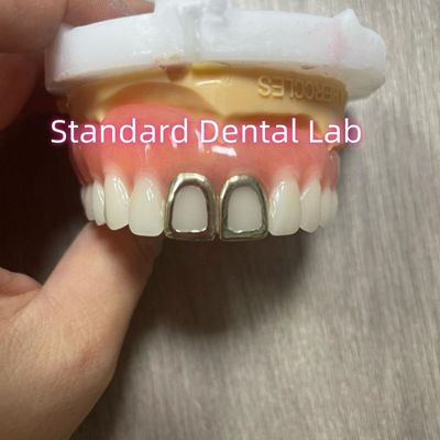 ISO ฟันเทียมอะคริลิคเต็มฟันสีเหลืองทองหน้าเปิด