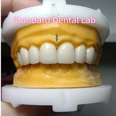 Ivoclar Zirconia Crown Veneers ความโปร่งใสสูง